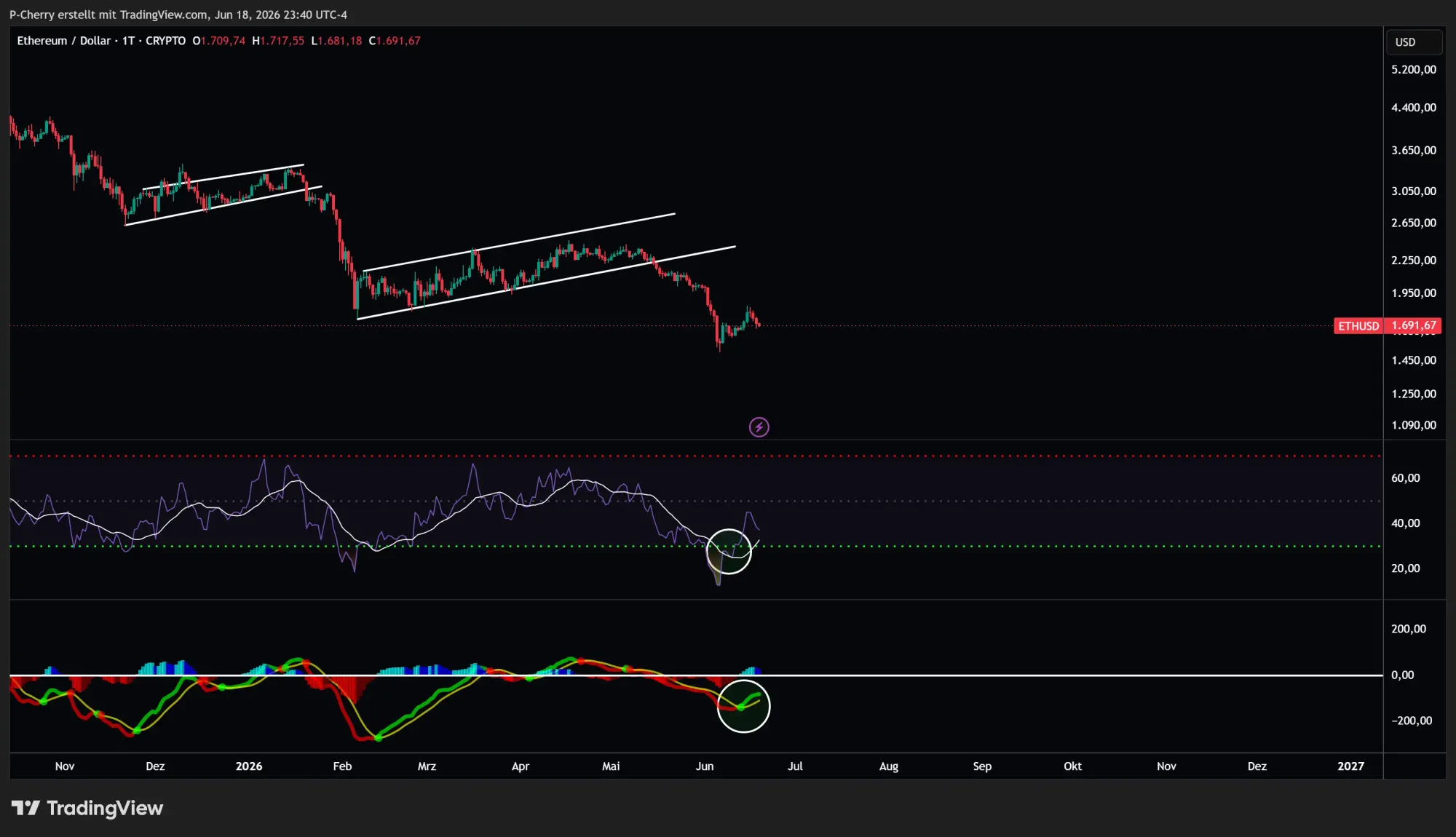 Ethereum, RSI und MACD, Tageschart, Quelle: Tradingview